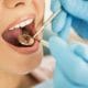 What are Dental Crowns and Bridges and What are Their Benefits