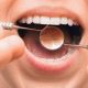 Effective Ways to Avoid Gum And Jaw Bone Diseases
