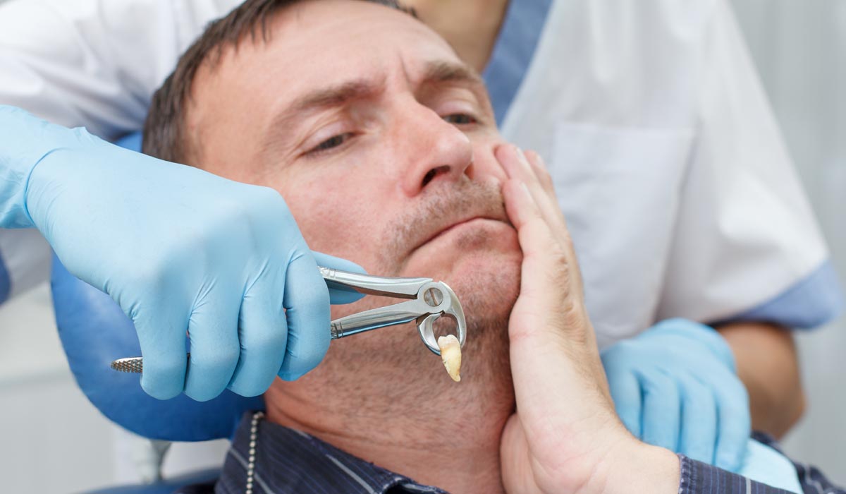 Tooth extraction at dental clinic