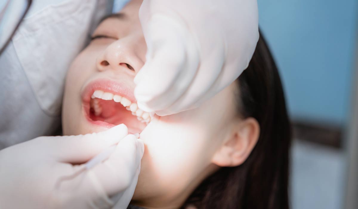 dentist removing tooth