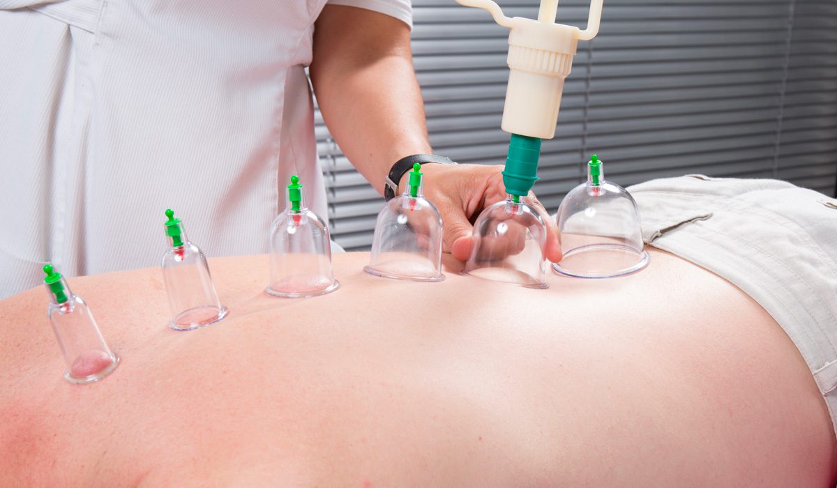 7dmc-hijama-therapy 7dmc-hijama-therapy