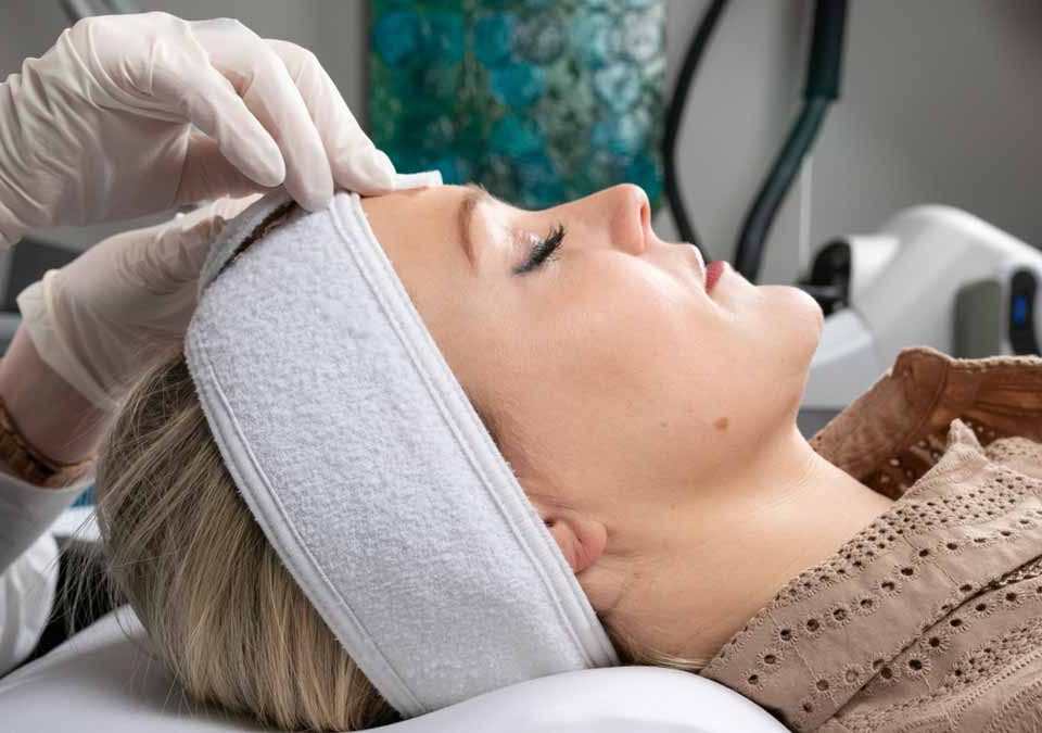 Chemical Peel for Acne Scars