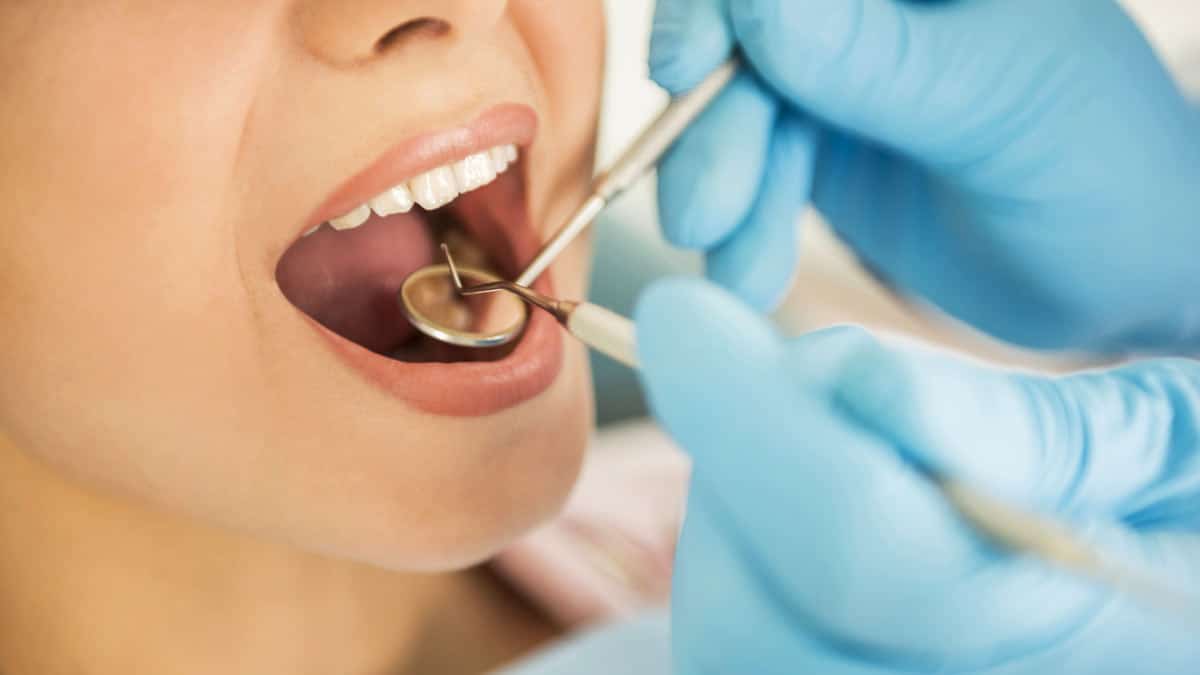 What are Dental Crowns and Bridges and What are Their Benefits