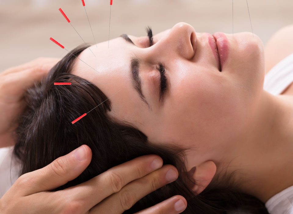 How effective is acupuncture for depression and anxiety