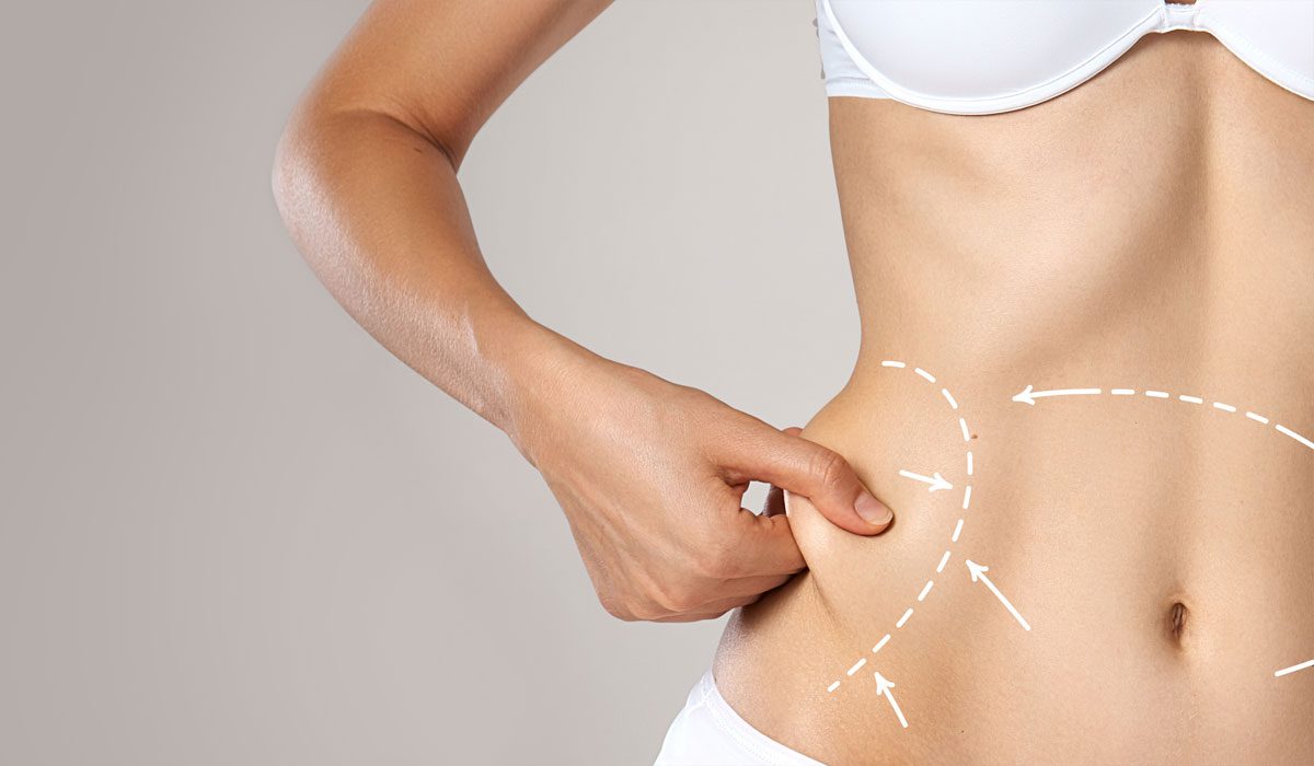 Is liposuction the best fat removal method?